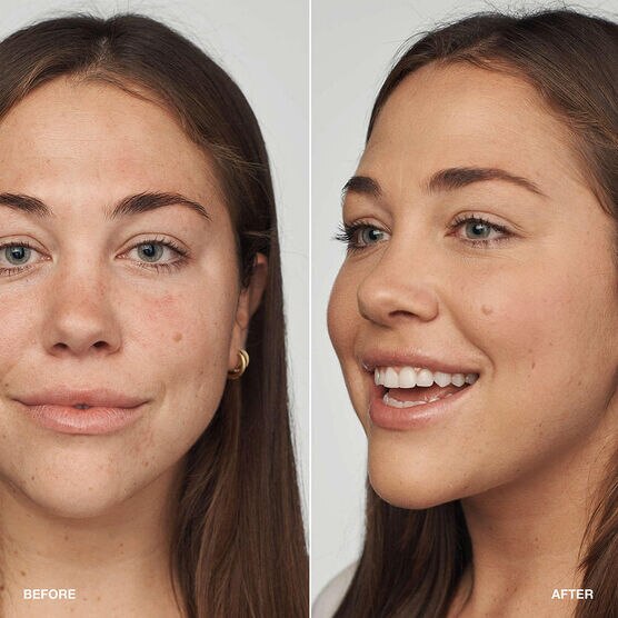 CLINIQUE   EVEN BETTER   FOUN 30ML